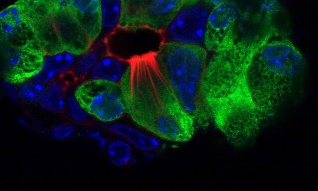 سلول هایی که می توانند به درمان سرطان پانکراس یاری نمایند