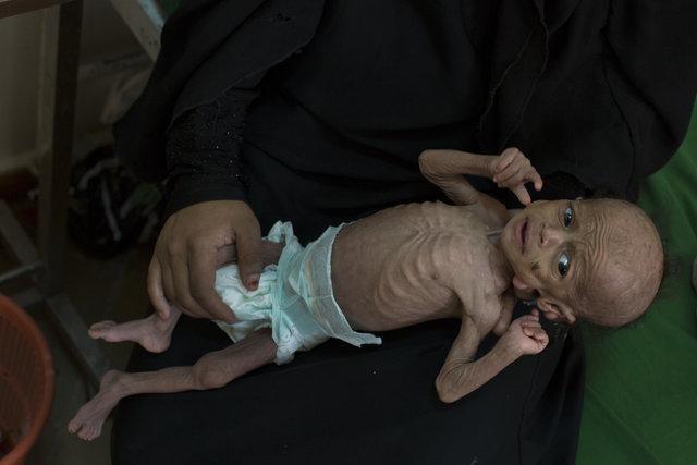 10 میلیون یمنی در یک قدمی گرسنگی